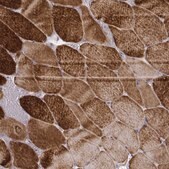 Monoclonal Anti-MYH6 antibody produced in mouse Prestige Antibodies&#174; Powered by Atlas Antibodies, clone CL2155, purified immunoglobulin, buffered aqueous glycerol solution