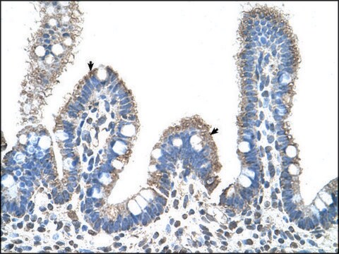 Anti-SLC22A1 (AB2) antibody produced in rabbit IgG fraction of antiserum