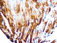 Anti-Cardiac troponin T (TNNT2) Antibody, clone 10H9D8, Rabbit Monoclonal