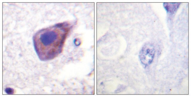 Anti-GZ-&#945; antibody produced in rabbit affinity isolated antibody