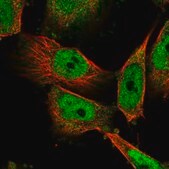 Anti-HDAC3 antibody produced in rabbit Prestige Antibodies&#174; Powered by Atlas Antibodies, affinity isolated antibody, buffered aqueous glycerol solution