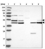 Anti-GSK3A antibody produced in rabbit Prestige Antibodies&#174; Powered by Atlas Antibodies, affinity isolated antibody, buffered aqueous glycerol solution