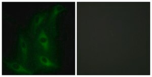 Anti-Collagen IV &#945;6 antibody produced in rabbit affinity isolated antibody
