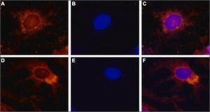 Anti-TRPV4 antibody produced in rabbit affinity isolated antibody, lyophilized powder