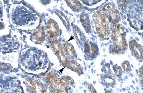 Anti-FOXF1 (AB2) antibody produced in rabbit IgG fraction of antiserum