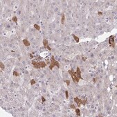 Anti-F2 antibody produced in rabbit Prestige Antibodies&#174; Powered by Atlas Antibodies, affinity isolated antibody, buffered aqueous glycerol solution