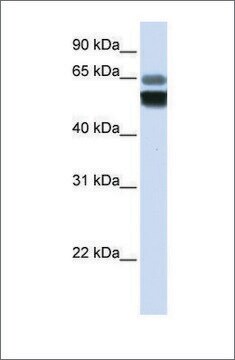 Anti-SMPD1 antibody produced in rabbit affinity isolated antibody