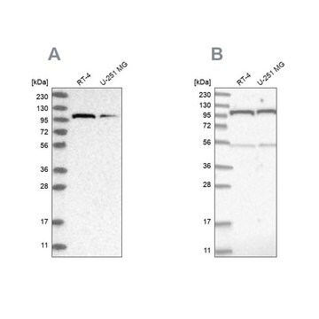 Anti-OGT antibody produced in rabbit Prestige Antibodies&#174; Powered by Atlas Antibodies, affinity isolated antibody, buffered aqueous glycerol solution, ab1