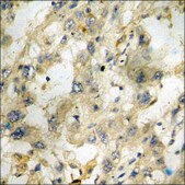 Anti-phospho-SYK (pTyr348) antibody produced in rabbit affinity isolated antibody