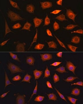 Anti- PHGDH antibody produced in rabbit