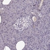 Anti-LUM antibody produced in rabbit Prestige Antibodies&#174; Powered by Atlas Antibodies, affinity isolated antibody, buffered aqueous glycerol solution