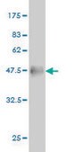 Monoclonal Anti-RTN2 antibody produced in mouse clone 6A11, purified immunoglobulin, buffered aqueous solution