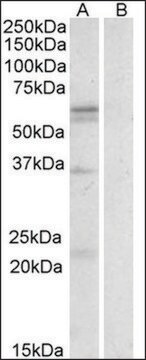 Anti-SLC7A5 antibody produced in goat affinity isolated antibody, buffered aqueous solution