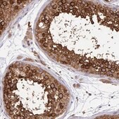 Anti-KIF5B antibody produced in rabbit Prestige Antibodies&#174; Powered by Atlas Antibodies, affinity isolated antibody
