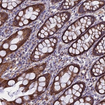 Anti-TGFA antibody produced in rabbit Prestige Antibodies&#174; Powered by Atlas Antibodies, affinity isolated antibody, buffered aqueous glycerol solution