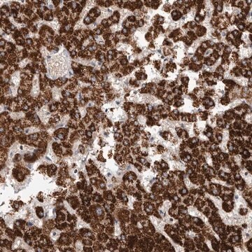 Anti-RNF217 antibody produced in rabbit Prestige Antibodies&#174; Powered by Atlas Antibodies, affinity isolated antibody, buffered aqueous glycerol solution