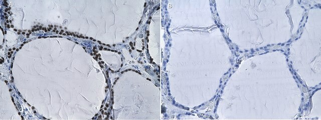 Anti-NKX2-1 Antibody, clone 1H5-H2 ZooMAb&#174; Rabbit Monoclonal recombinant, expressed in HEK 293 cells