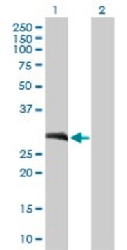 Anti-LOR antibody produced in mouse purified immunoglobulin, buffered aqueous solution