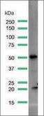 Anti-PTEN antibody, Rabbit monoclonal recombinant, expressed in proprietary host, clone SP170, affinity isolated antibody