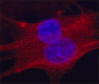 Anti-Troponin T antibody, Mouse monoclonal clone JLT-12, purified from hybridoma cell culture