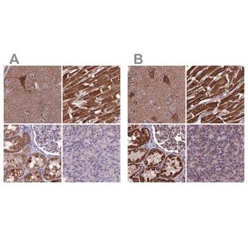 Anti-CS antibody produced in rabbit Prestige Antibodies&#174; Powered by Atlas Antibodies, affinity isolated antibody, buffered aqueous glycerol solution