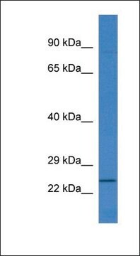 Anti-RNF183 antibody produced in rabbit affinity isolated antibody