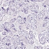 Anti-DEFA5 antibody produced in rabbit Prestige Antibodies&#174; Powered by Atlas Antibodies, affinity isolated antibody, buffered aqueous glycerol solution