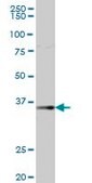 Anti-AKR1B1 antibody produced in mouse purified immunoglobulin, buffered aqueous solution