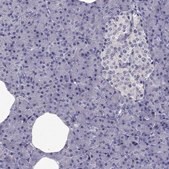 Anti-SLC6A2 Prestige Antibodies&#174; Powered by Atlas Antibodies, affinity isolated antibody