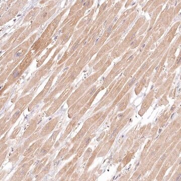 Anti-INPP4B antibody produced in rabbit Prestige Antibodies&#174; Powered by Atlas Antibodies, affinity isolated antibody, buffered aqueous glycerol solution