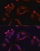Anti-TYMS antibody produced in rabbit