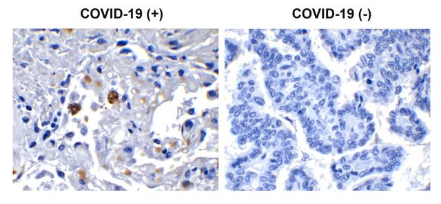 Anti-SARS-CoV-2 (COVID-19) NSP13 (Helicase) antibody produced in rabbit affinity isolated antibody