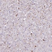 Anti-SRD5A1 antibody produced in rabbit Prestige Antibodies&#174; Powered by Atlas Antibodies, affinity isolated antibody, buffered aqueous glycerol solution