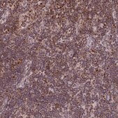 Anti-POLA2 antibody produced in rabbit Prestige Antibodies&#174; Powered by Atlas Antibodies, affinity isolated antibody, buffered aqueous glycerol solution