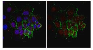 Anti-trimethyl-Histone H3 (Lys36) Antibody from rabbit, purified by affinity chromatography