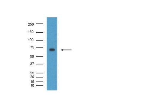 Anti-BACE Antibody, CT, clone 61-3E7 clone 61-3E7, Chemicon&#174;, from mouse