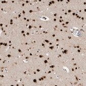 Anti-BCLAF1 antibody produced in rabbit Prestige Antibodies&#174; Powered by Atlas Antibodies, affinity isolated antibody, buffered aqueous glycerol solution