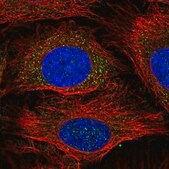 Anti-GSTM1 antibody produced in rabbit Prestige Antibodies&#174; Powered by Atlas Antibodies, affinity isolated antibody, buffered aqueous glycerol solution