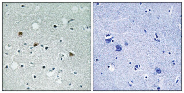 Anti-phospho-LATS1/2 (pThr1079/1041) antibody produced in rabbit affinity isolated antibody