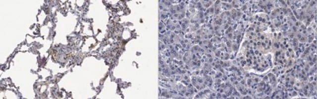 Anti-Surfactant Protein D from rabbit, purified by affinity chromatography