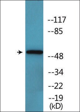 Anti-phospho-Keratin 8 (pSer432) antibody produced in rabbit affinity isolated antibody