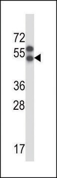 ANTI-APLNR (CENTER) antibody produced in rabbit IgG fraction of antiserum, buffered aqueous solution