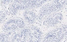 Anti-PPP3CC Antibody, clone 2C2 ZooMAb&#174; Rabbit Monoclonal recombinant, expressed in HEK 293 cells