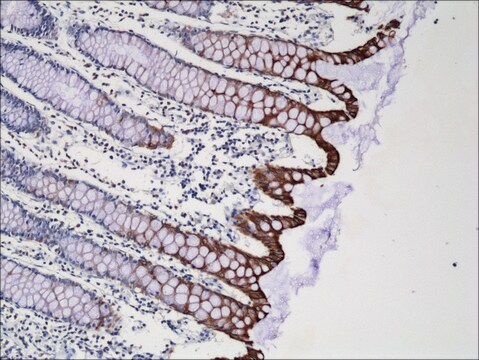 Anti-Cytokeratin-20 antibody, Rabbit Monoclonal recombinant, expressed in HEK 293 cells, clone RM283, purified immunoglobulin