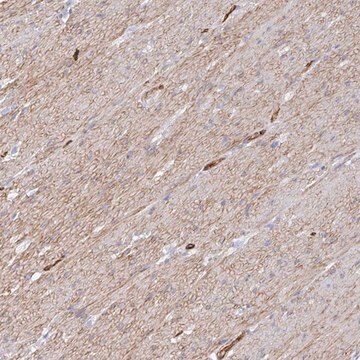 Anti-COX16 antibody produced in rabbit Prestige Antibodies&#174; Powered by Atlas Antibodies, affinity isolated antibody, buffered aqueous glycerol solution