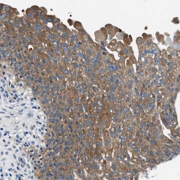 Anti-TWF1 antibody produced in rabbit Prestige Antibodies&#174; Powered by Atlas Antibodies, affinity isolated antibody, buffered aqueous glycerol solution