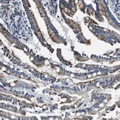 Anti-OGDH antibody produced in rabbit Prestige Antibodies&#174; Powered by Atlas Antibodies, affinity isolated antibody, buffered aqueous glycerol solution