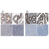 Anti-PGR antibody produced in rabbit Ab1, Prestige Antibodies&#174; Powered by Atlas Antibodies, affinity isolated antibody, buffered aqueous glycerol solution