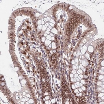 Anti-RPP25 antibody produced in rabbit Prestige Antibodies&#174; Powered by Atlas Antibodies, affinity isolated antibody, buffered aqueous glycerol solution