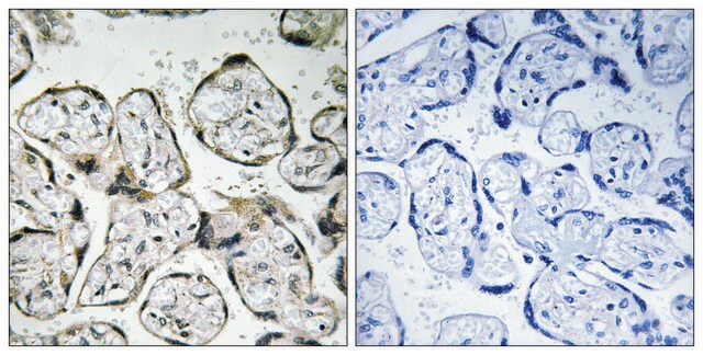 Anti-MT-ND1 antibody produced in rabbit affinity isolated antibody